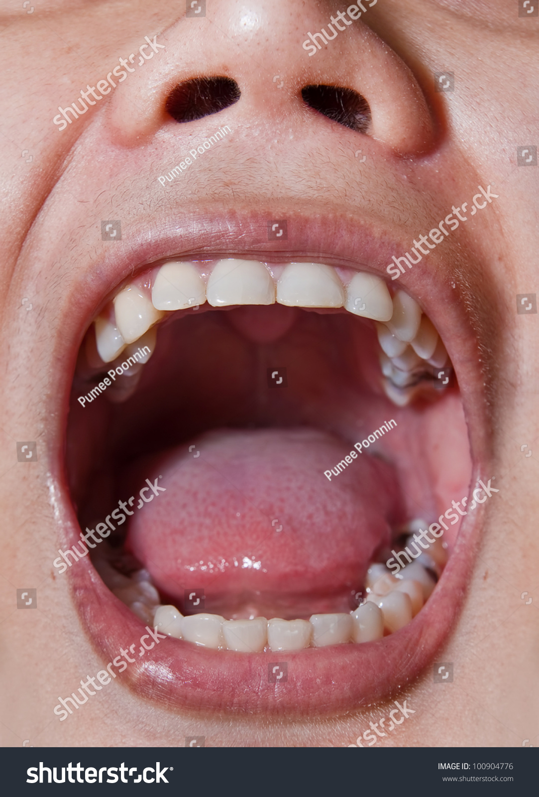Scream Mouth 95