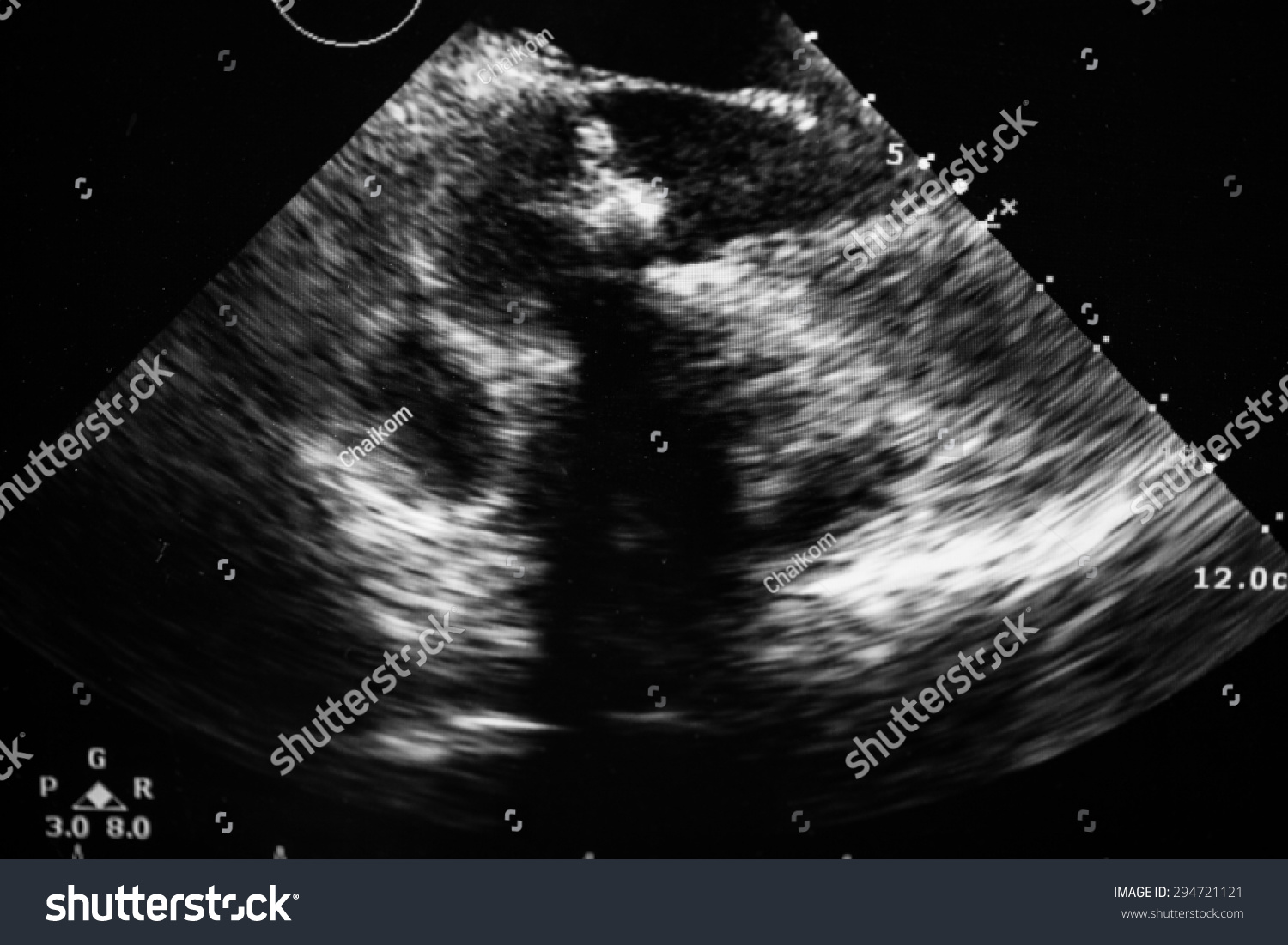 Screen Echocardiography Ultrasound Machine Stock Photo 294721121