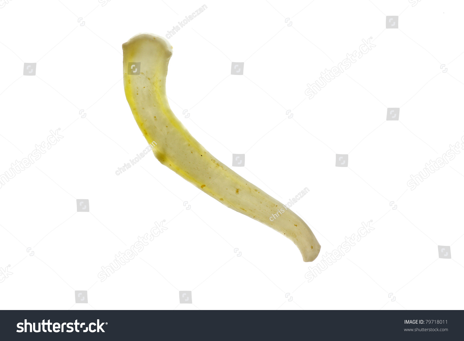 Single Segment Mature Tapeworm Taenia Sp Stock Photo 79718011