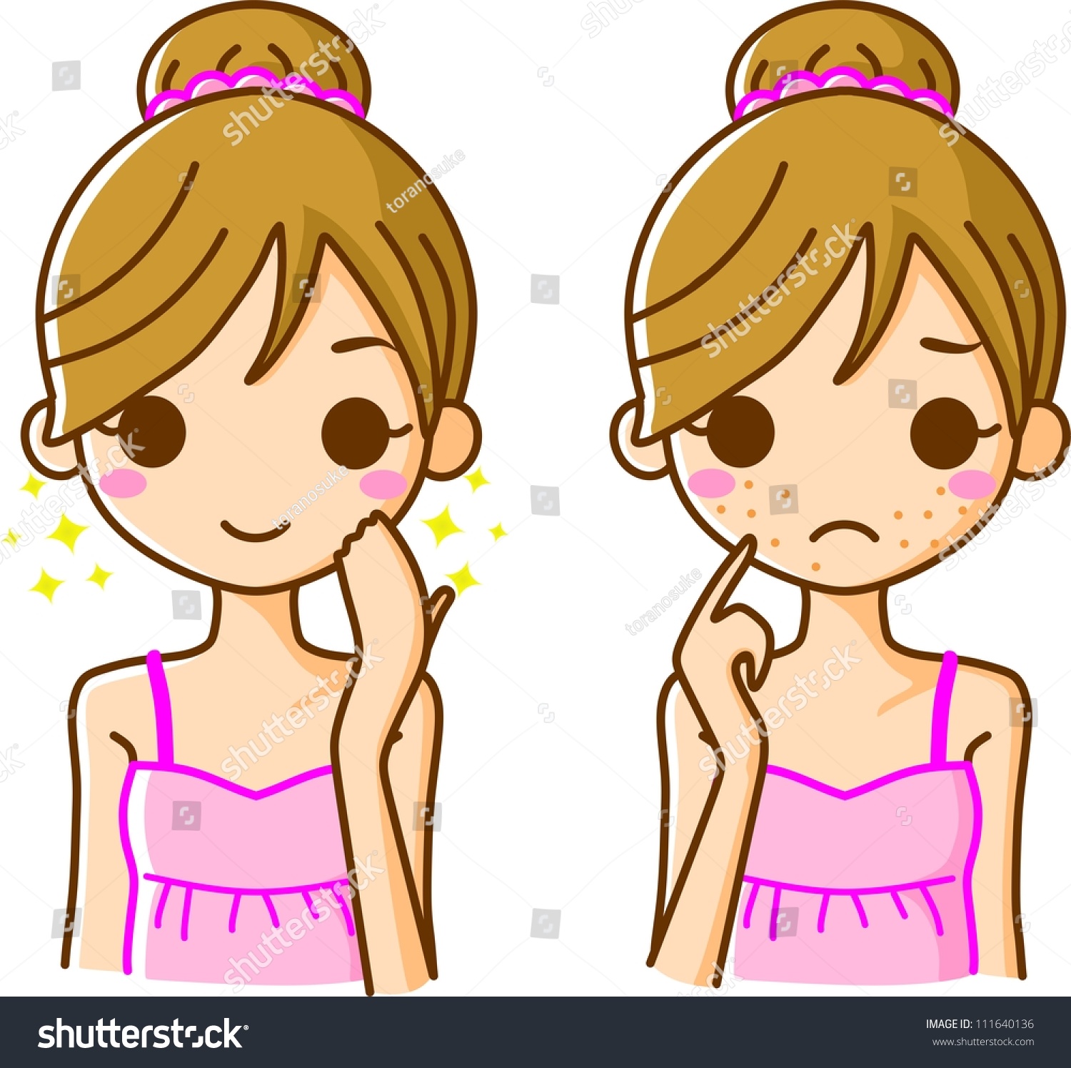 Skin Acne Illustration Stock Illustration 111640136