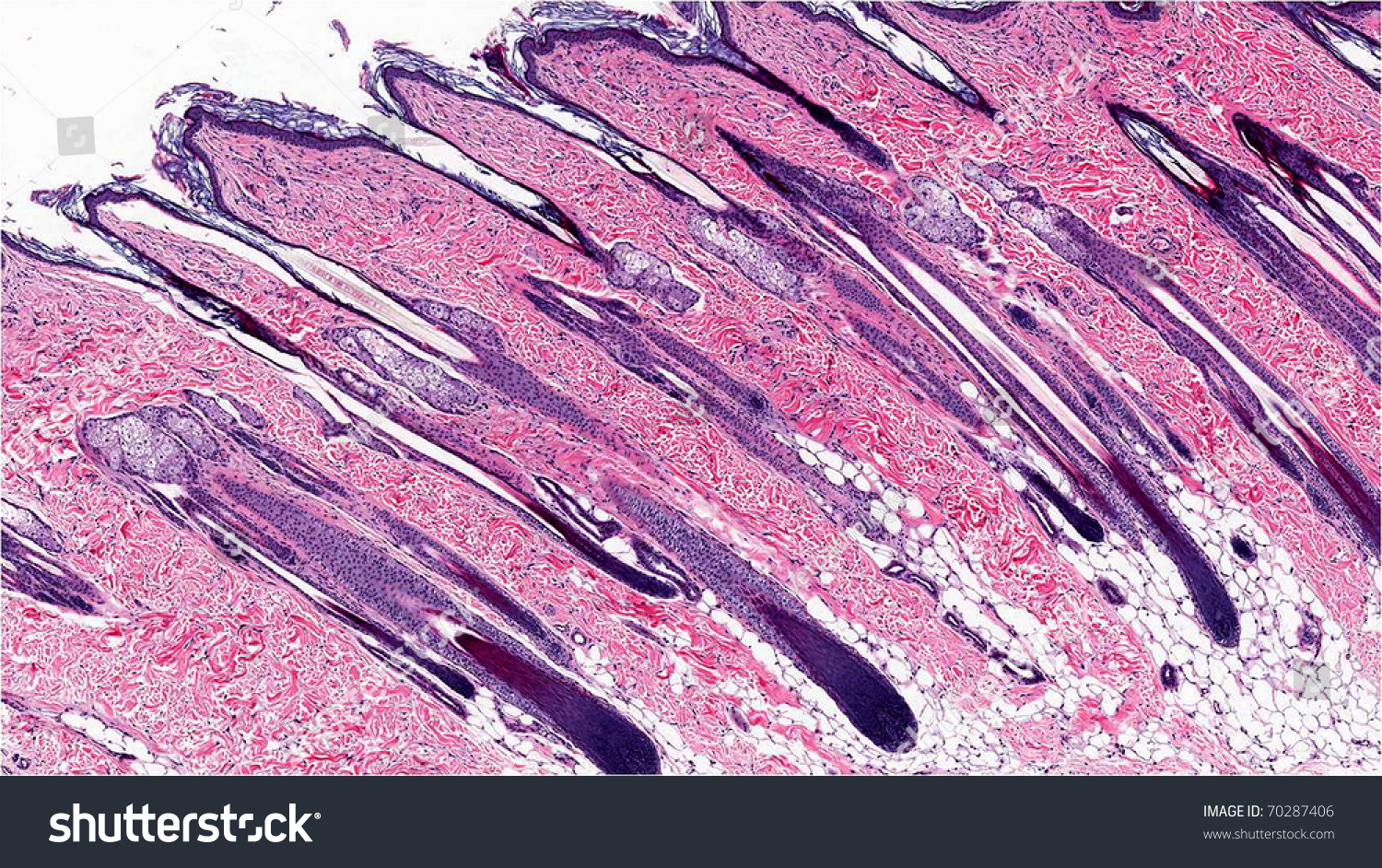Skin Showing Hair Follicles And Sebaceous Glands - Microscopic Anatomy