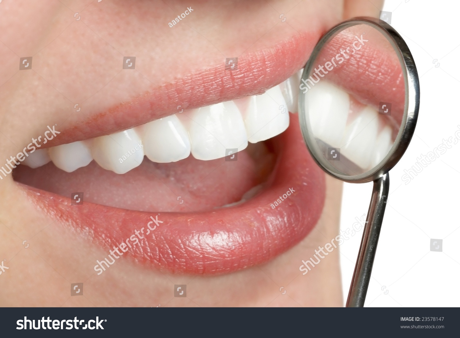 Smiling White Teeth Mouth With Dental Mirror Stock Photo 23578147 