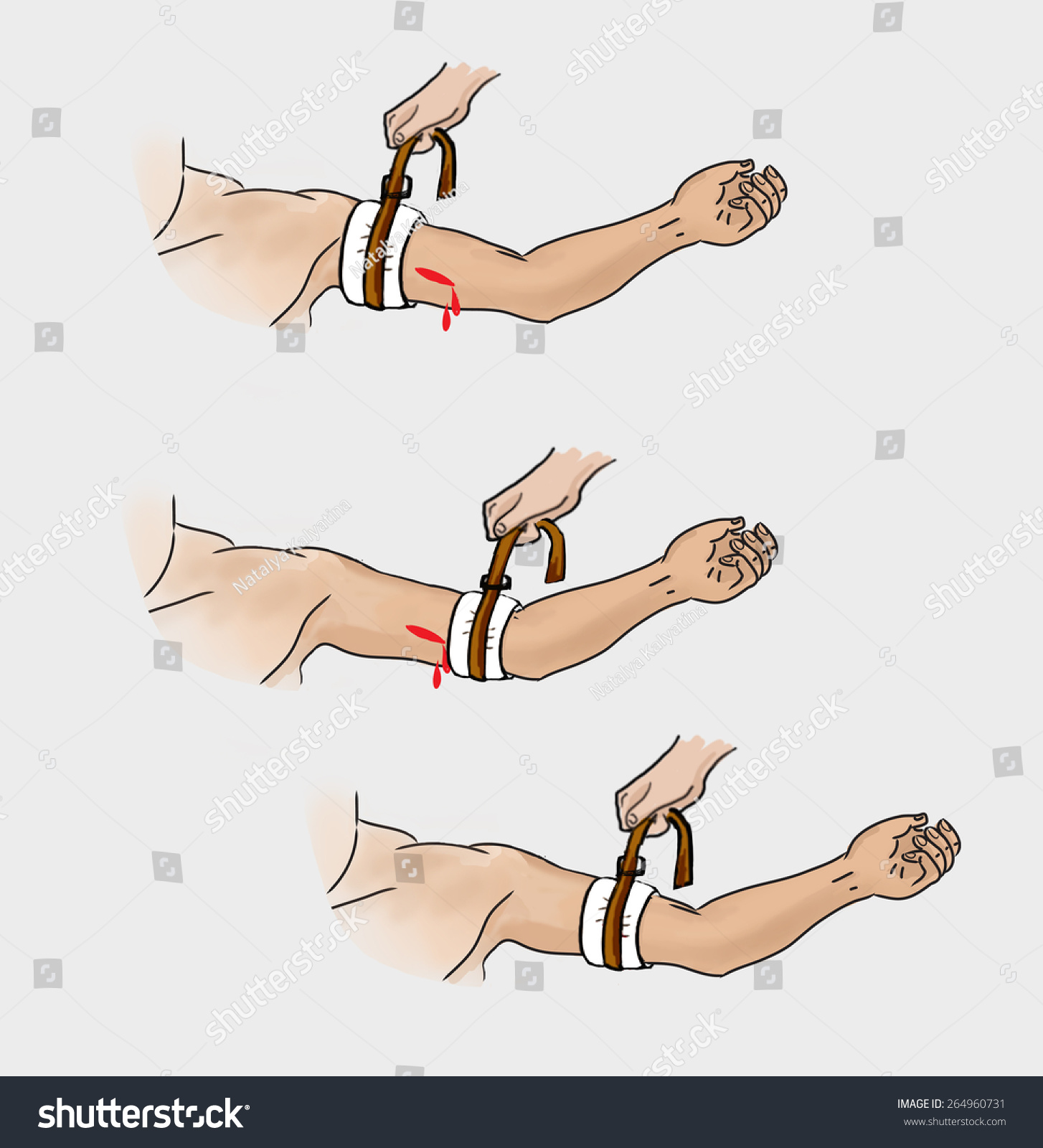 Stop Bleeding Tourniquet Instructions Illustration Tourniquet Stock