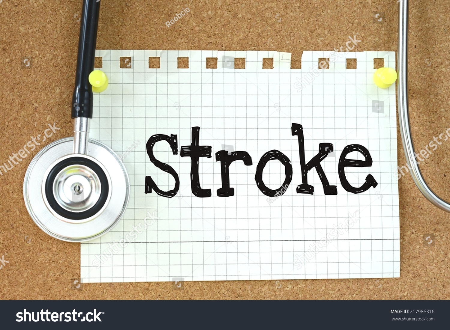 stroke risk paper Oral contraceptives increase the risk of ischemic stroke, but this risk is very small among women who do not have other stroke risk factors, according to a jan 3, 2018 paper in the journal medlink neurology by loyola medicine. stroke risk paper Oral contraceptives increase the risk of ischemic stroke, but this risk is very small among women who do not have other stroke risk factors, according to a jan 3, 2018 paper in the journal medlink neurology by loyola medicine.