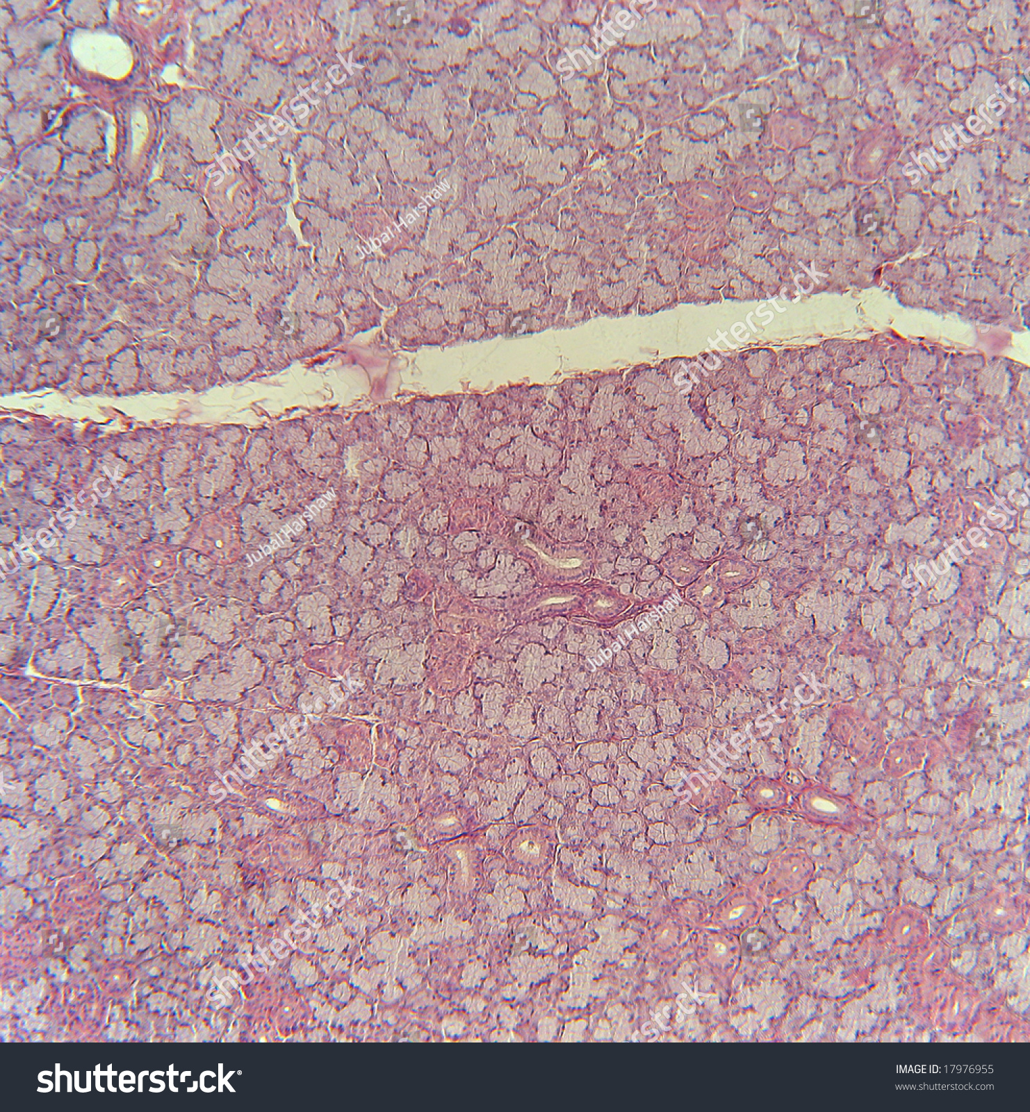 Submaxillary Gland Portion Of A Cross Section Low Power Showing Serous And Mucoid Alveoli 0207