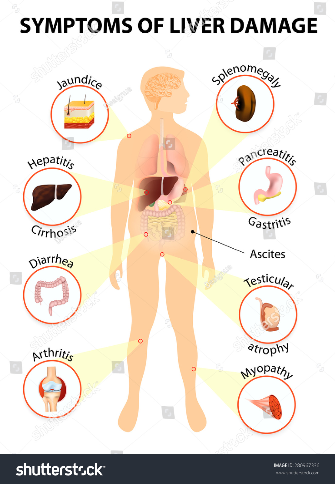 Symptoms Of Liver Damage. Human Silhouette With Internal Organs Stock