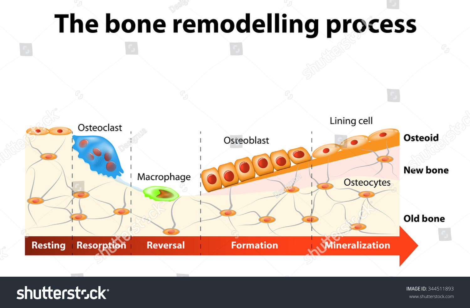 The Bone Remodeling Process Involves The Following Steps In A Healthy Body Osteoclasts And 