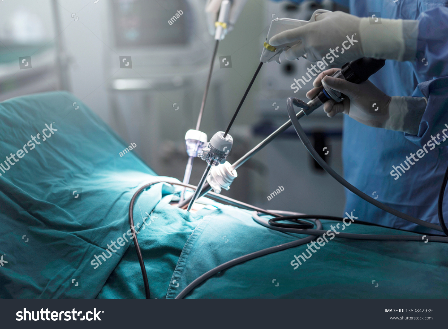 Laparoscopic Surgery Images Stock Photos Vectors Shutterstock