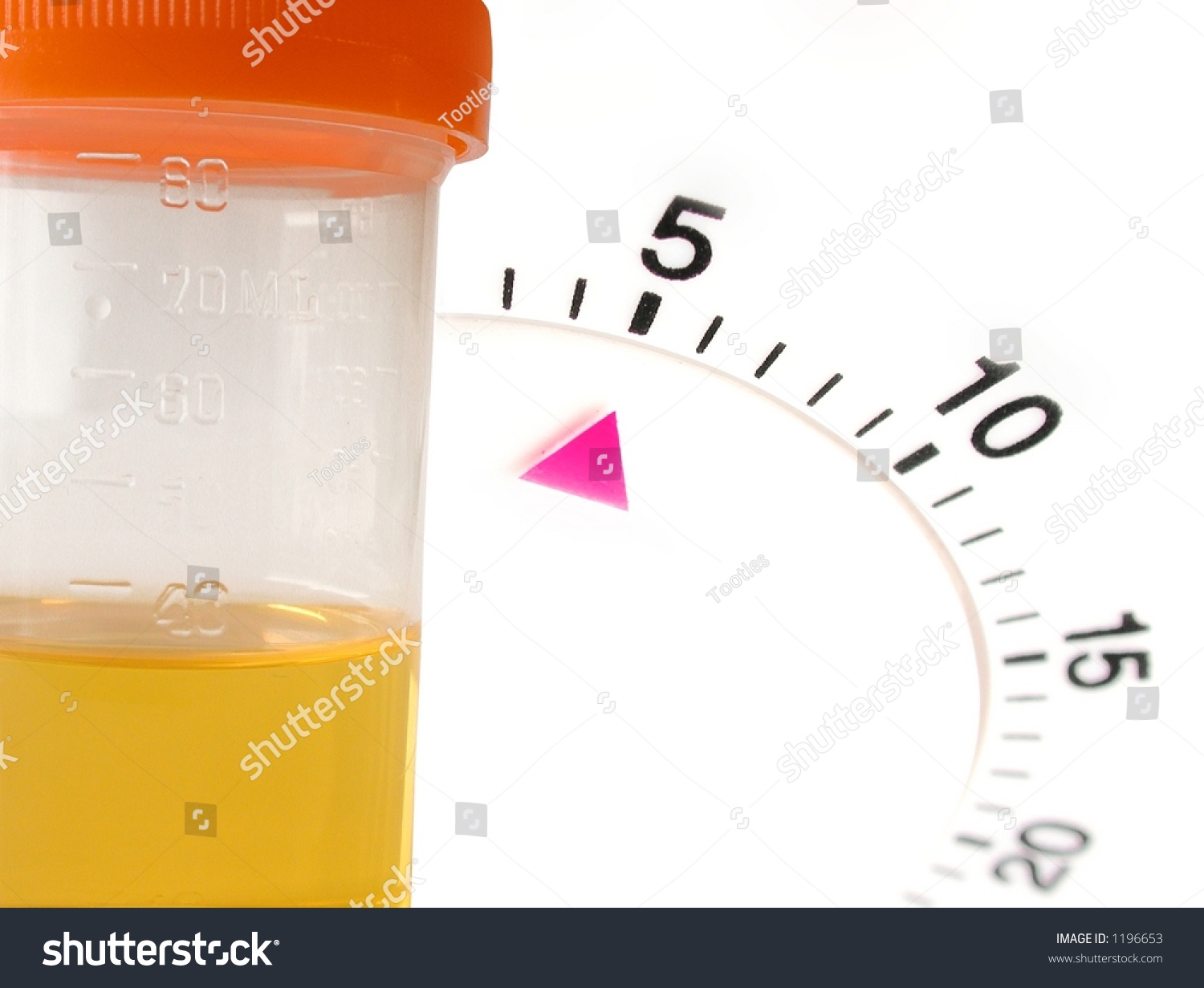 timed-urine-sample-test-stock-photo-1196653-shutterstock