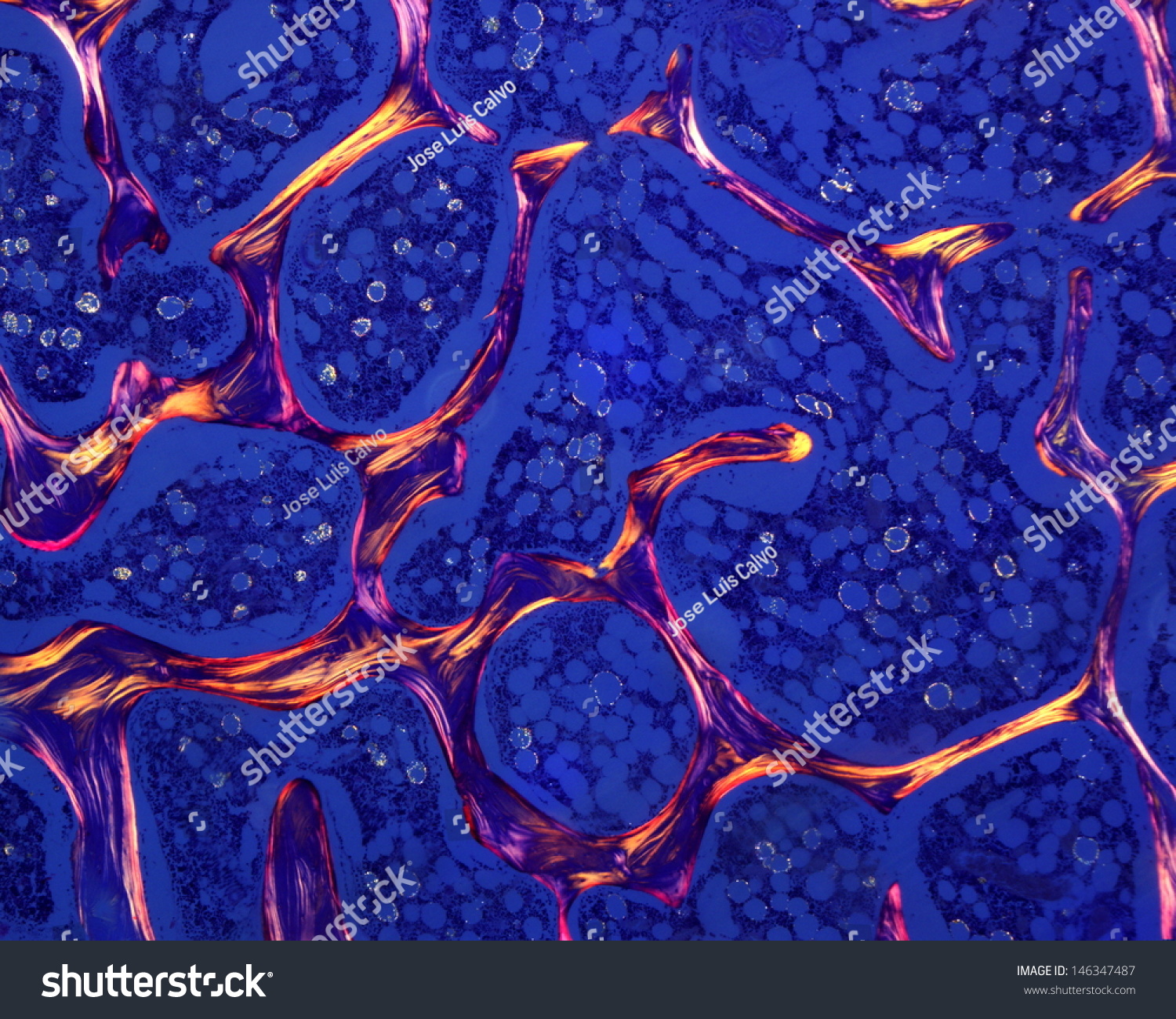 Trabecular Or Spongy Bone As Seen Under A Polarized Light Microscope