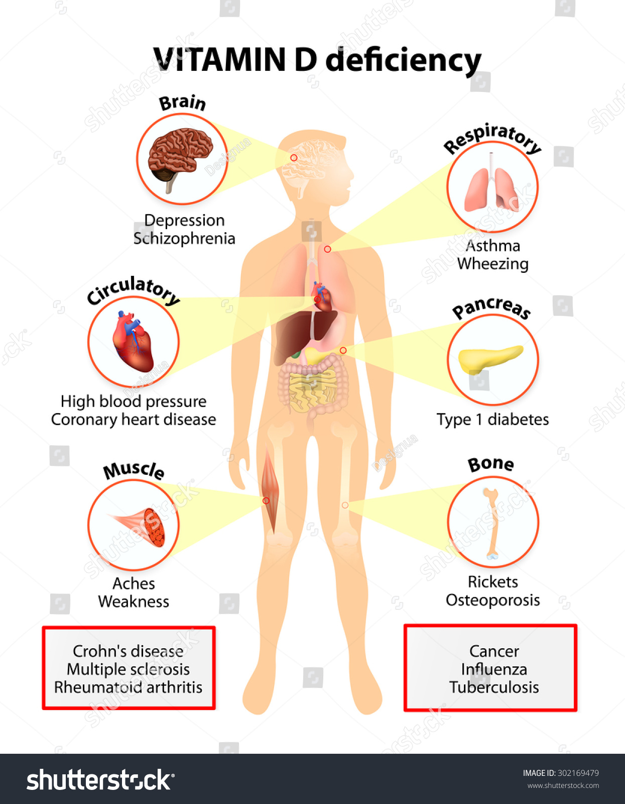 coronary artery disease research paper coronary artery disease research paper