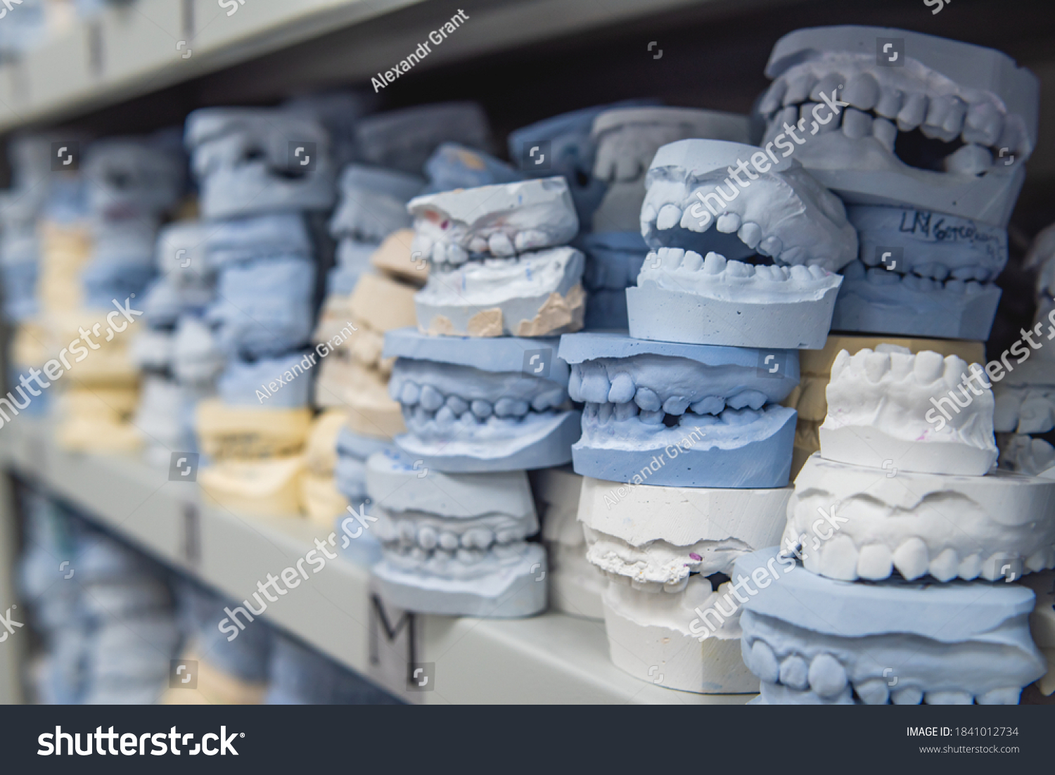 Warehouse Plaster Models Human Jaws Orthodontic Stock Photo Edit Now