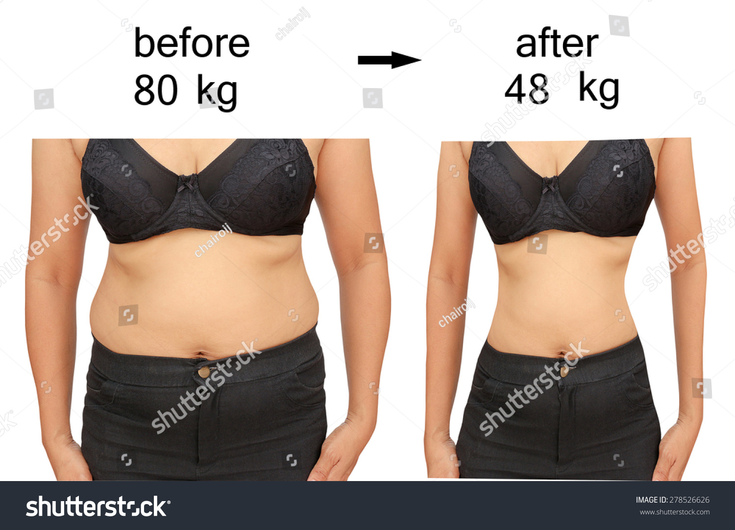 Womans Body Before After Diet ภาพสตอก 278526626 Shutterstock