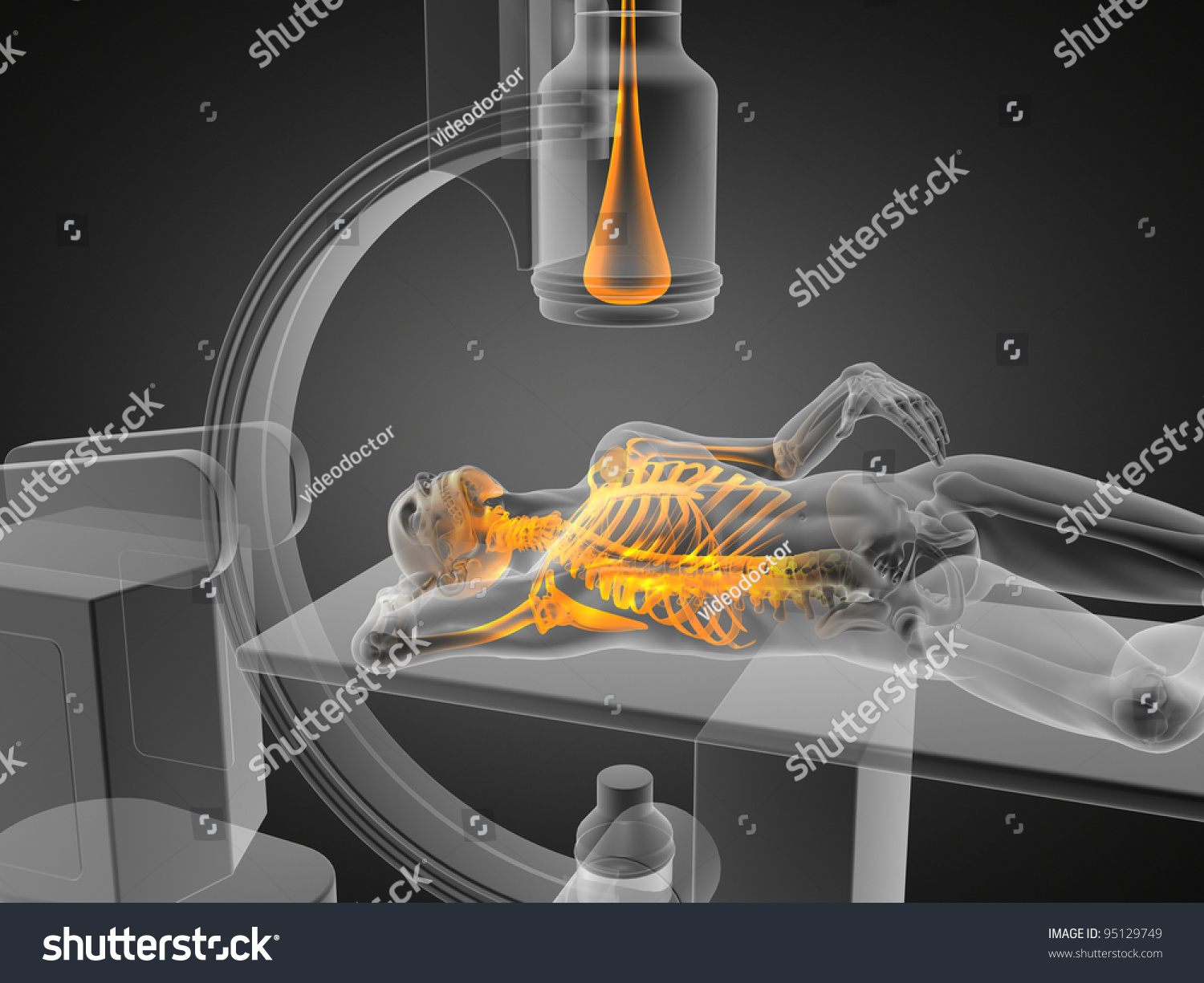 XRay Examination Made In 3d Graphics Stock Photo 95129749 Shutterstock