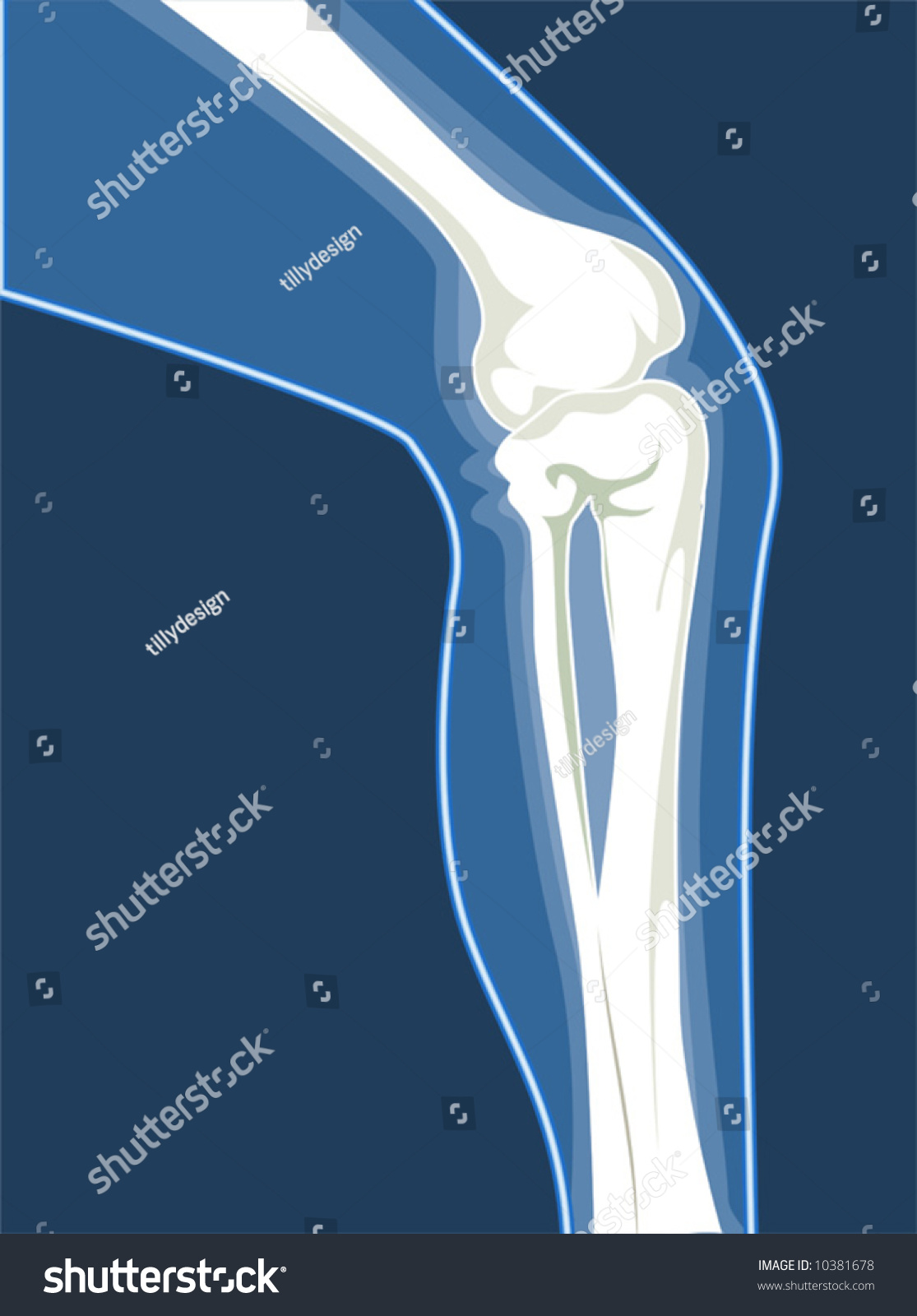 Human Leg Bones Stock Vector Illustration 10381678 Shutterstock 1044