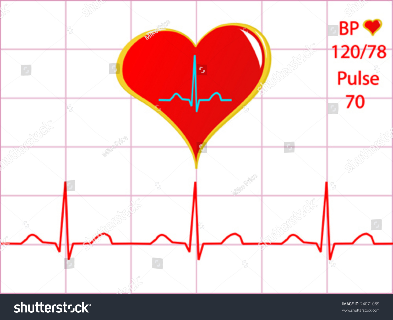 A Healthy Heart Vector Illustration With A Cardiac Trace Showing Normal