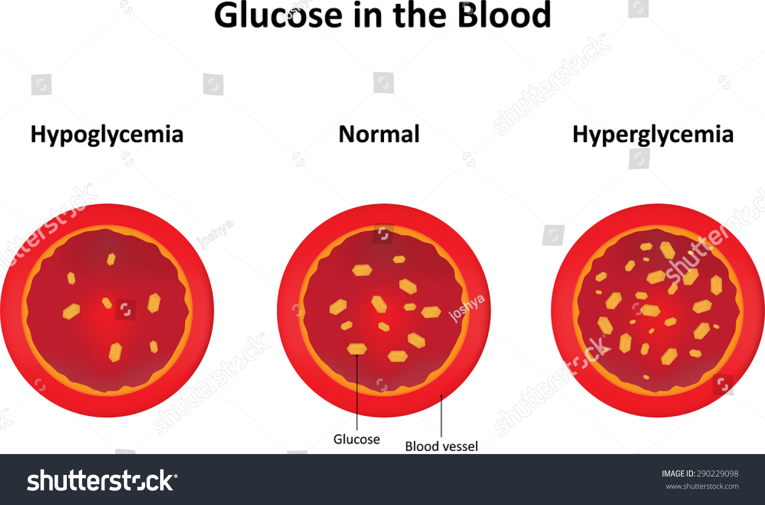 Resultado de imagen para glucose in the blood