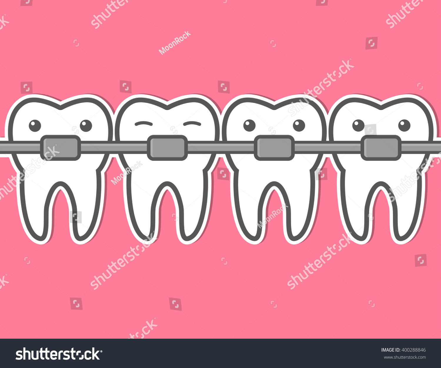 Cartoon Tooth Braces Vector Illustration Stock Vector 400288846