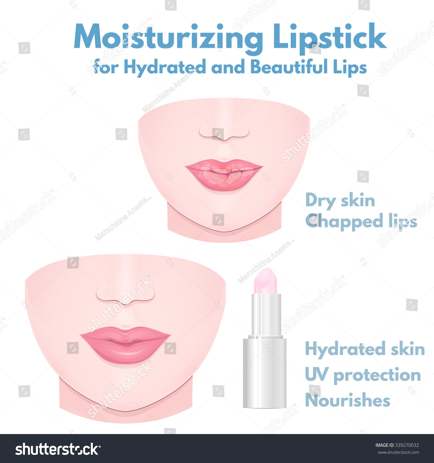 dry-cracked-lips-sore-lips-close-up-chapped-lips-in-winter-and