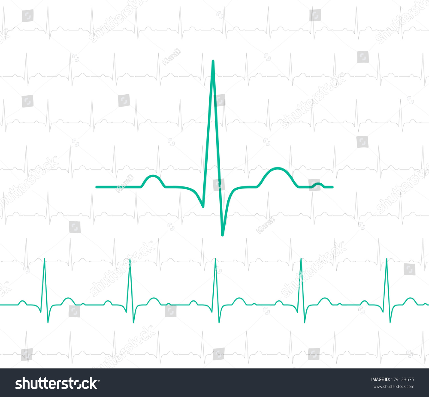 Ekg Symbol On White Vector Medical Stock Vector 179123675 - Shutterstock