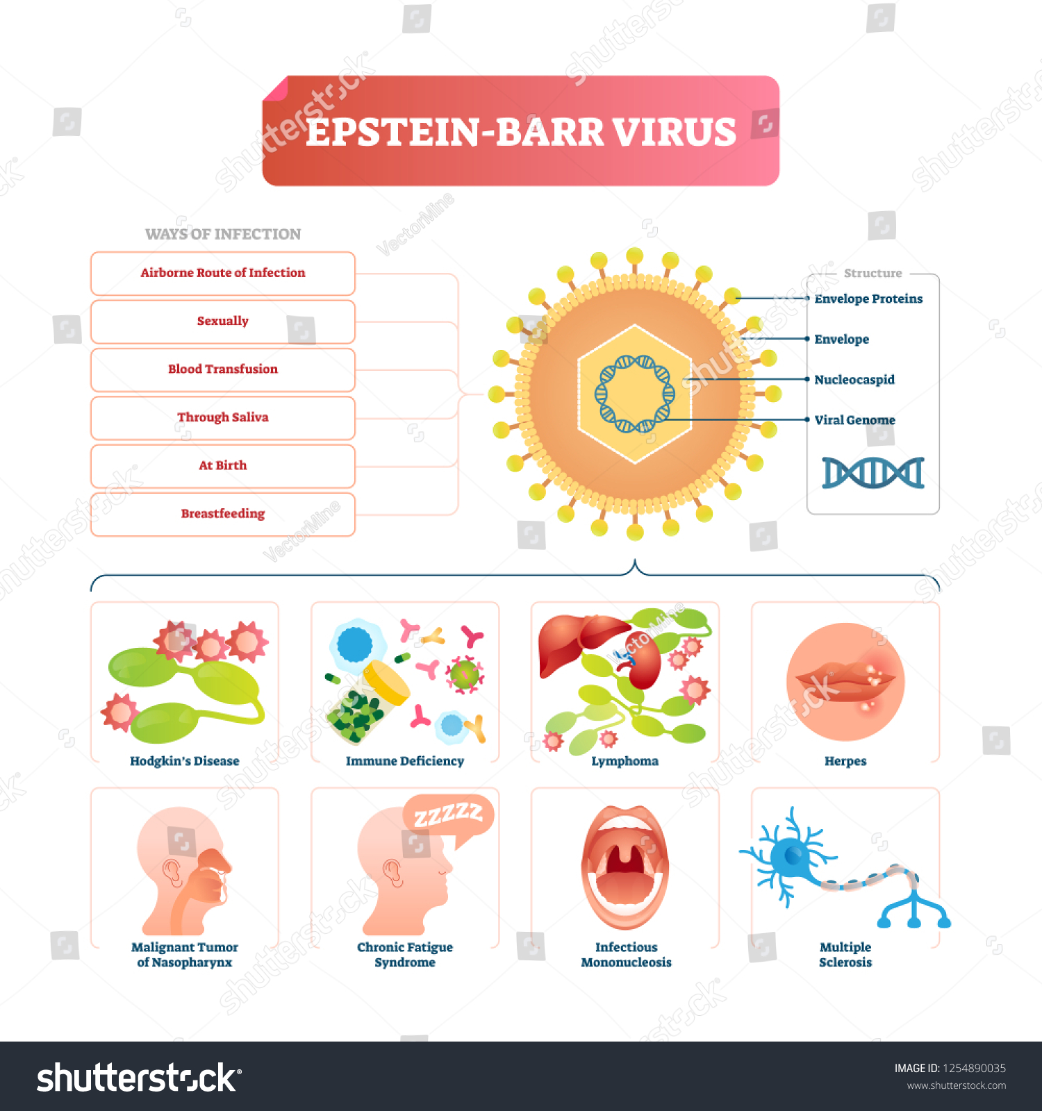 Epstein Barr Virus Vector Illustration Labeled Vetor Stock Livre De