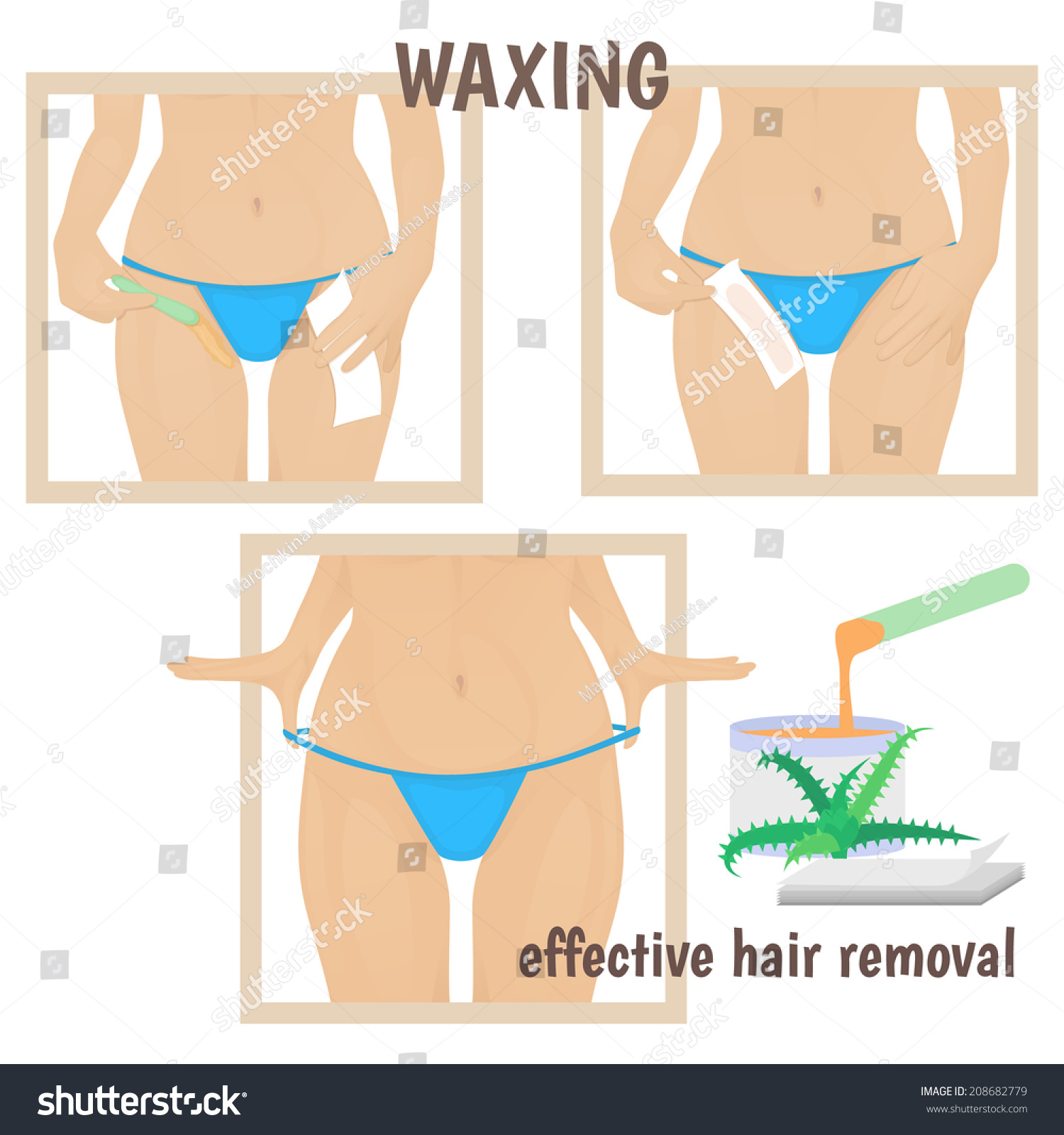 Female Torso, Woman In Blue Rubs Wax Hair Removal Bikini Area, Pictures Stages Stock Vector 