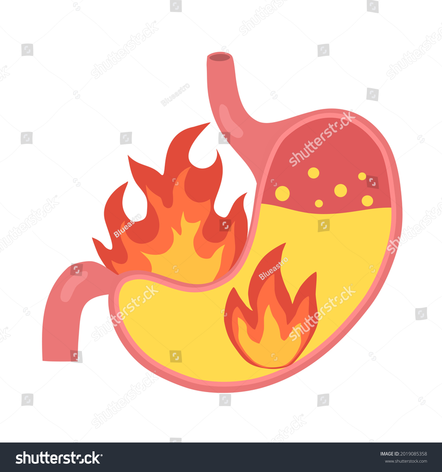 Human Stomach On Fire Flat Design Stock Vector Royalty Free