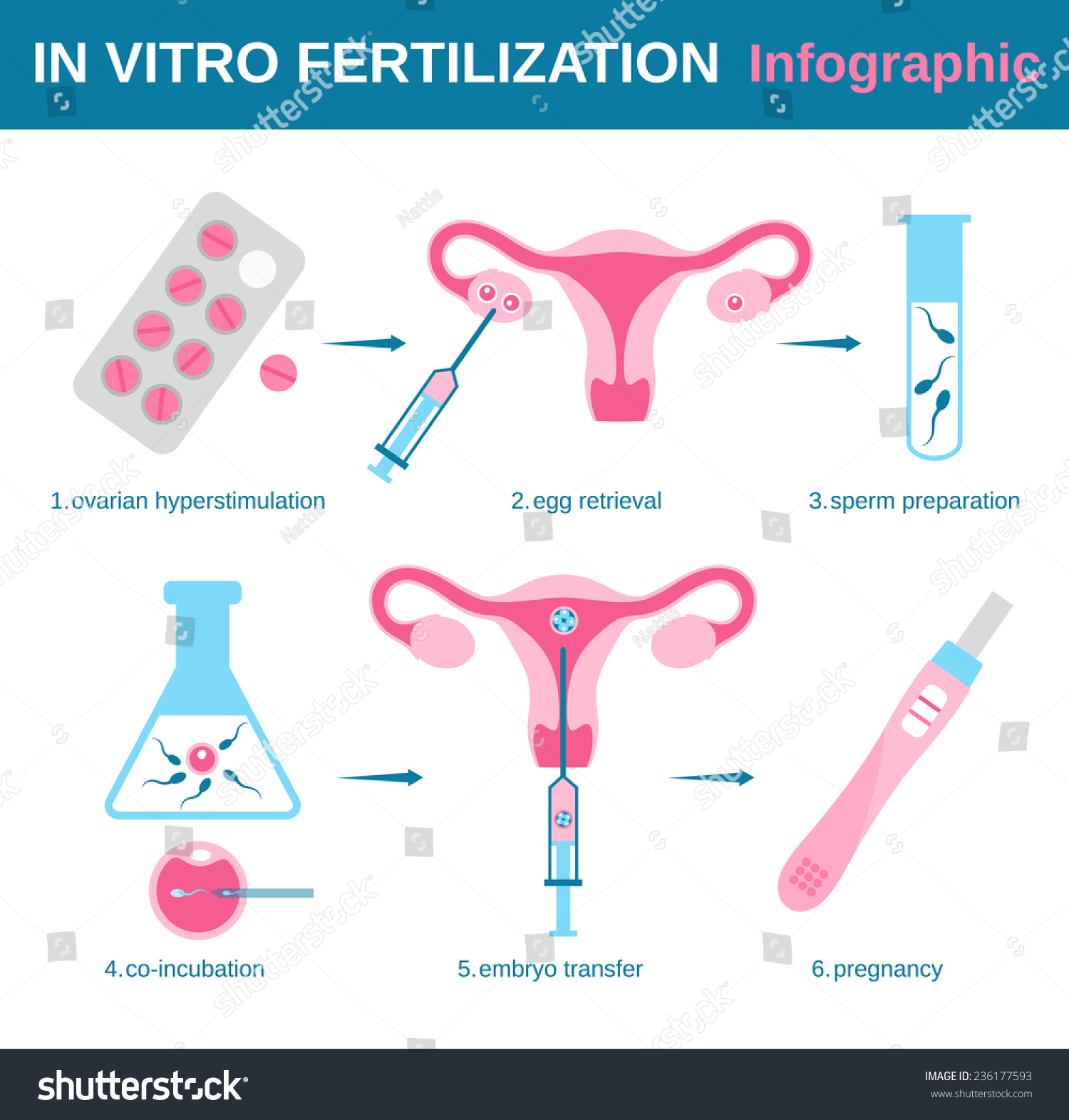 Vitro Fertilization Detailed Infographic Showing Laboratory Stock ...