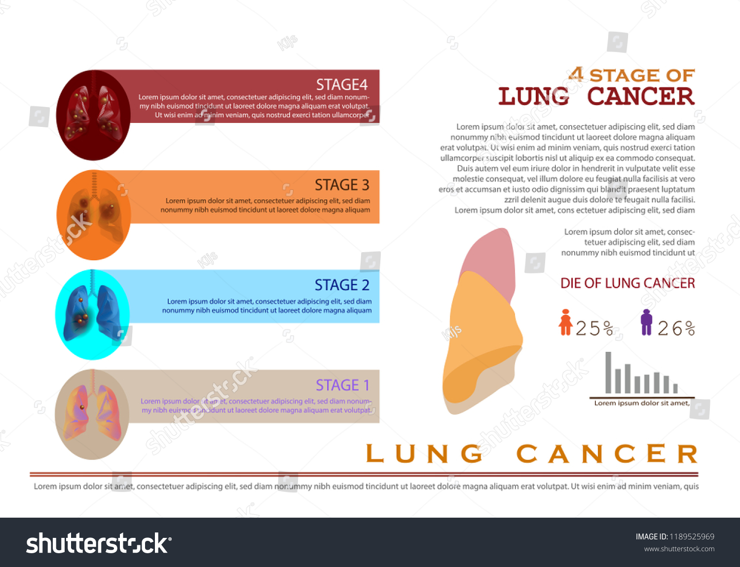 Lung Cancer Infographic Imformation Stock Vector Royalty Free