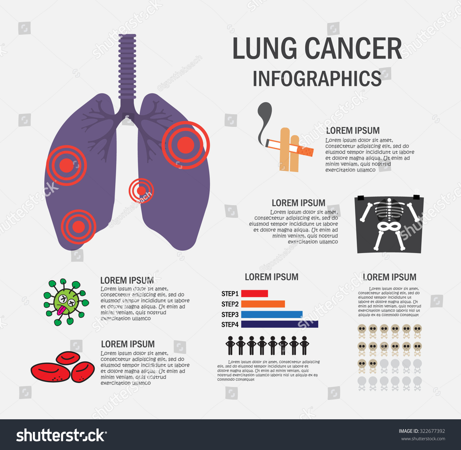 Lung Cancer Infographics Vector Illustration Stock Vector Royalty Free