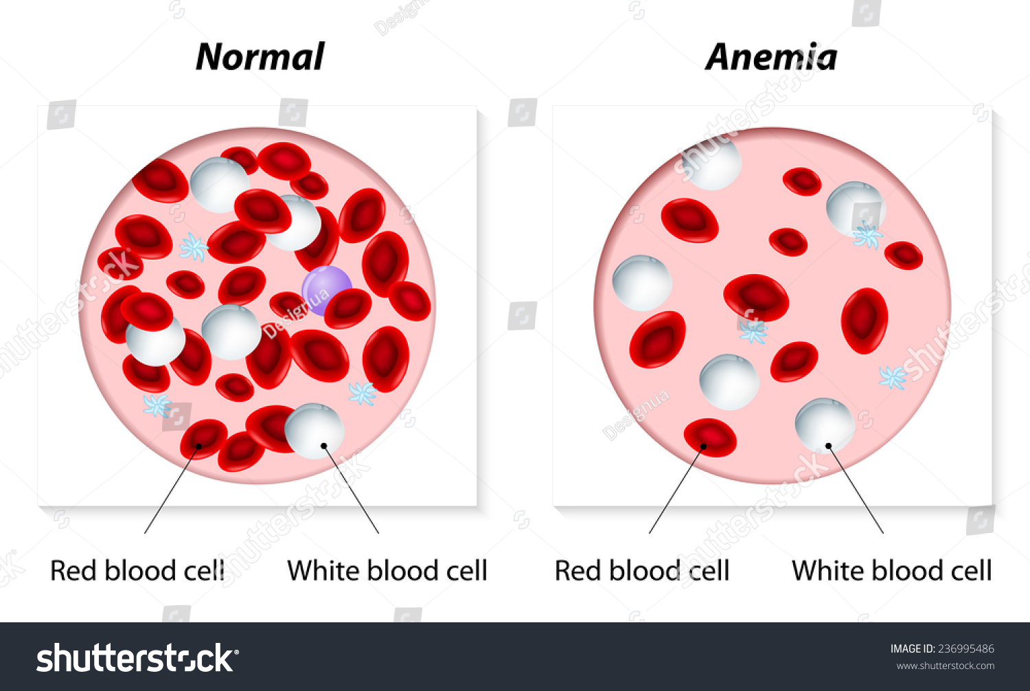 Redd Blood Cells Rar