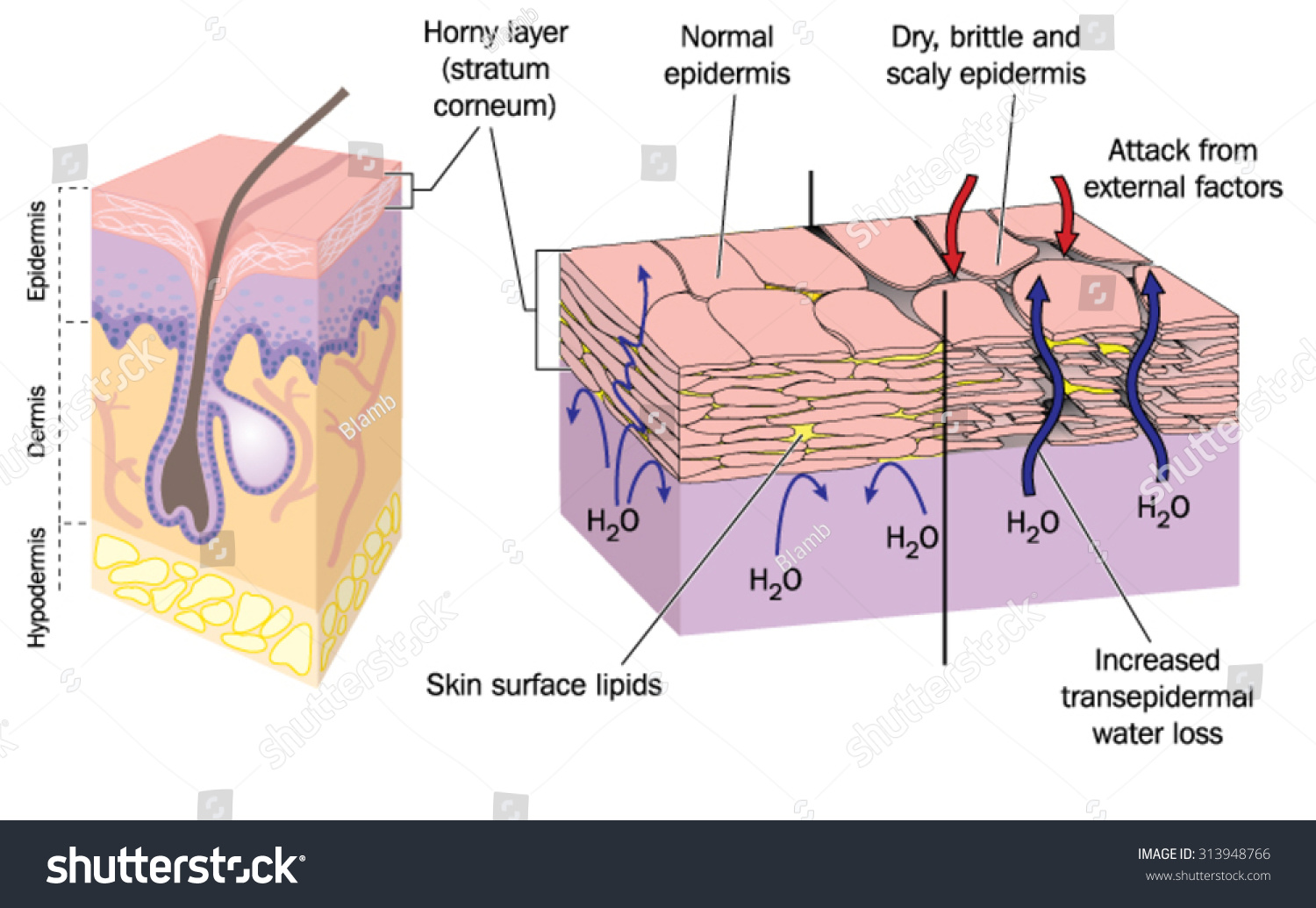 Anatomy Of The Epidermis Of The Skin Stock Vector