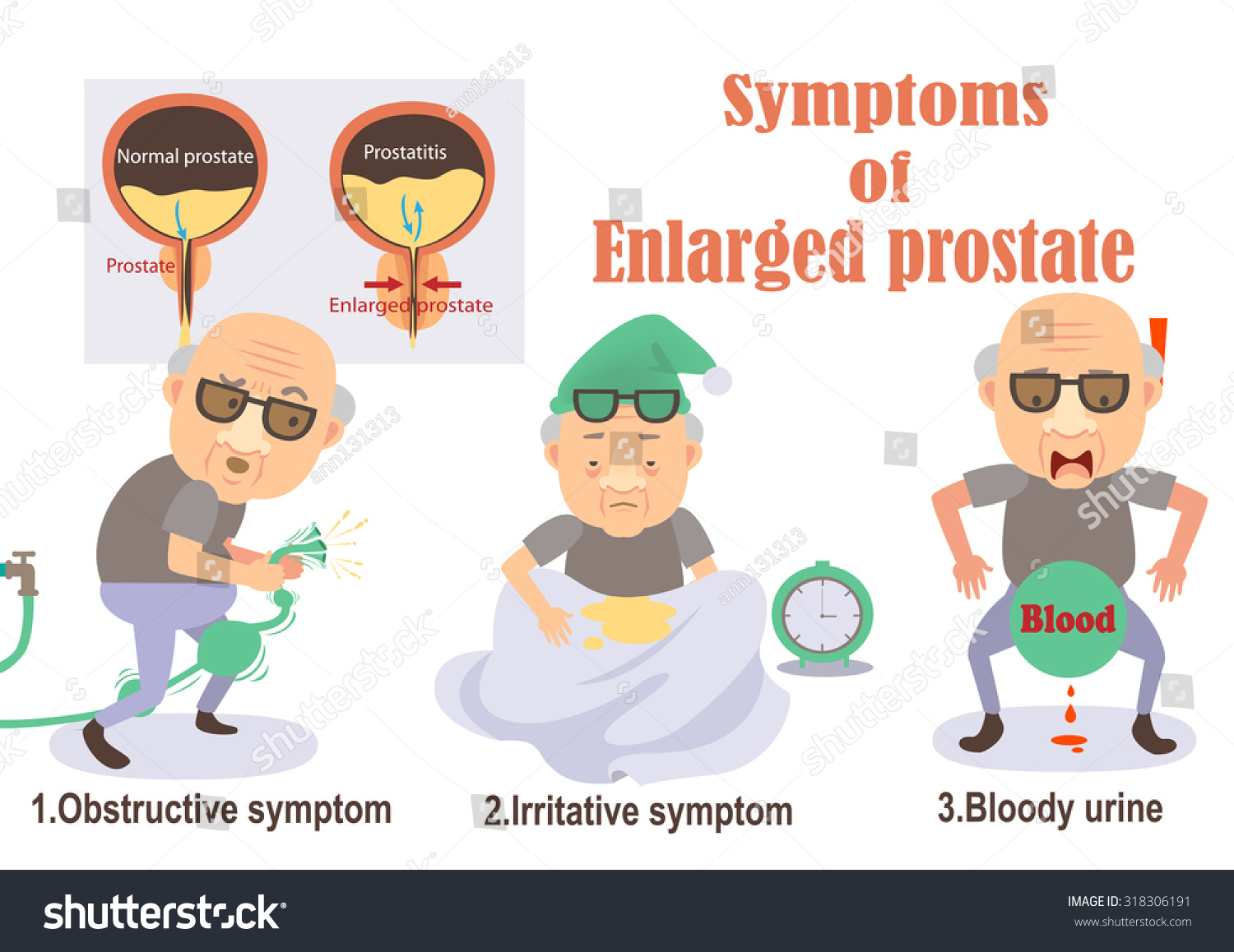 Symptoms Of Enlarged Prostate Infographicvector Illustration 318306191 Shutterstock 0069