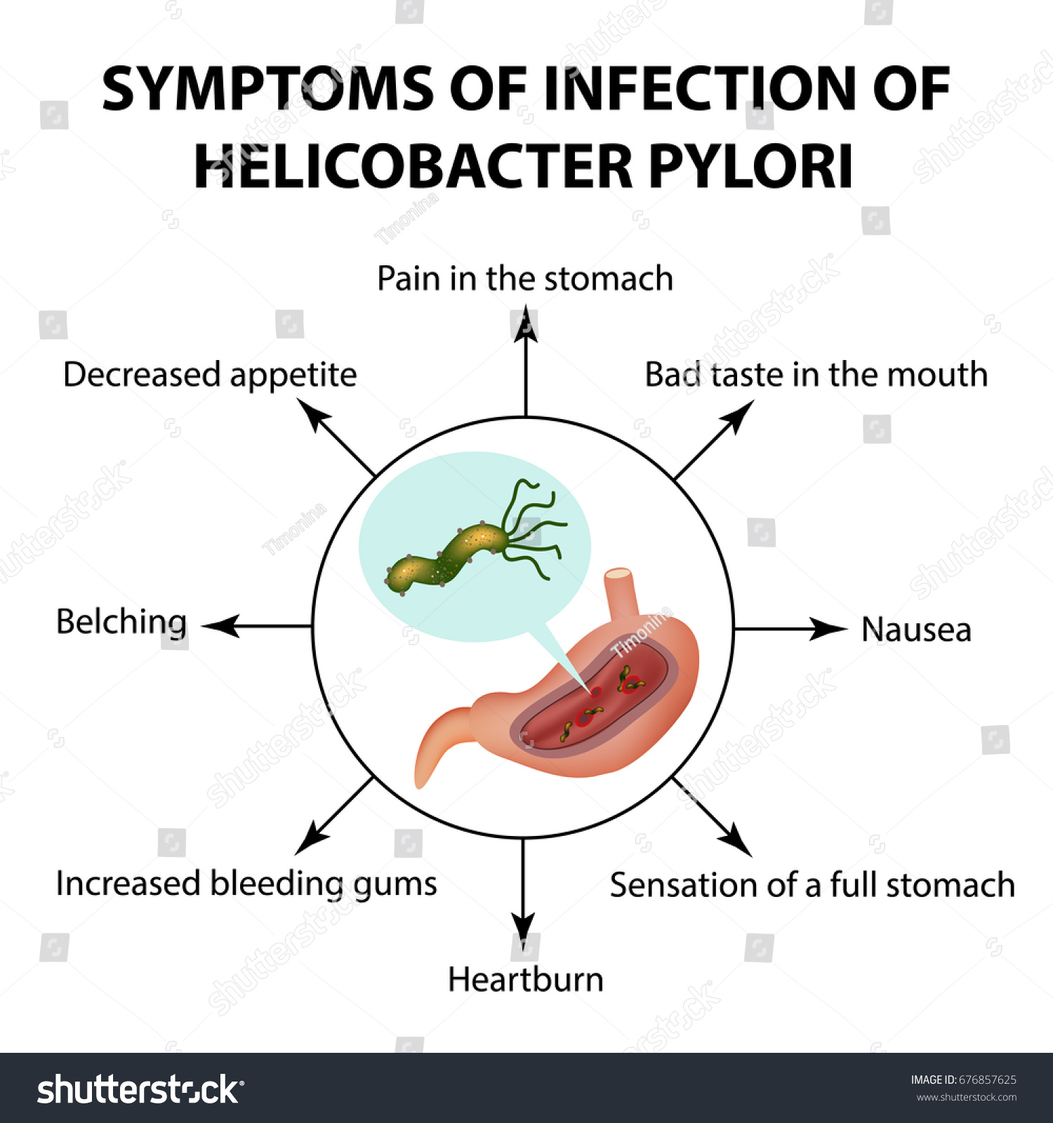 Symptoms Infection Helicobacter Pylori Infographics Vector Stock Vector 4260 Hot Sex Picture 2294