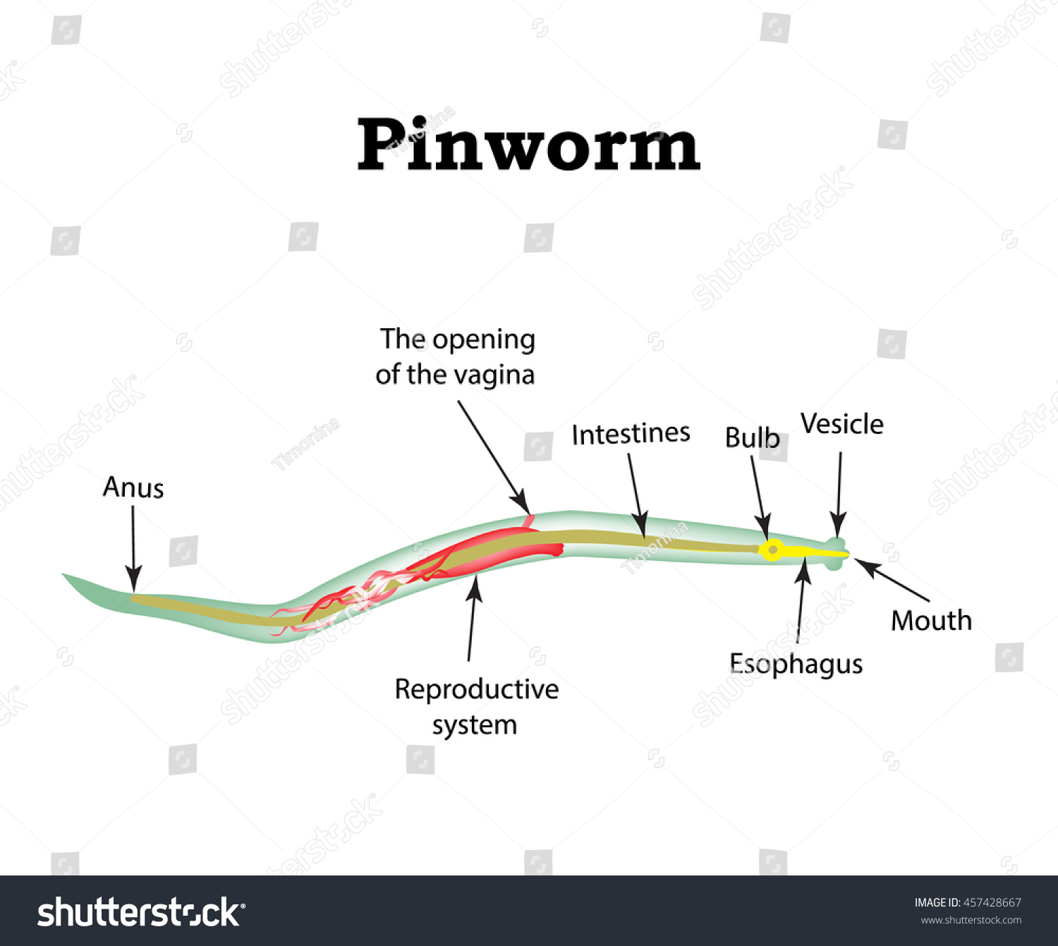 Structure Pinworms Pinworm Vector Illustration On Image Vectorielle