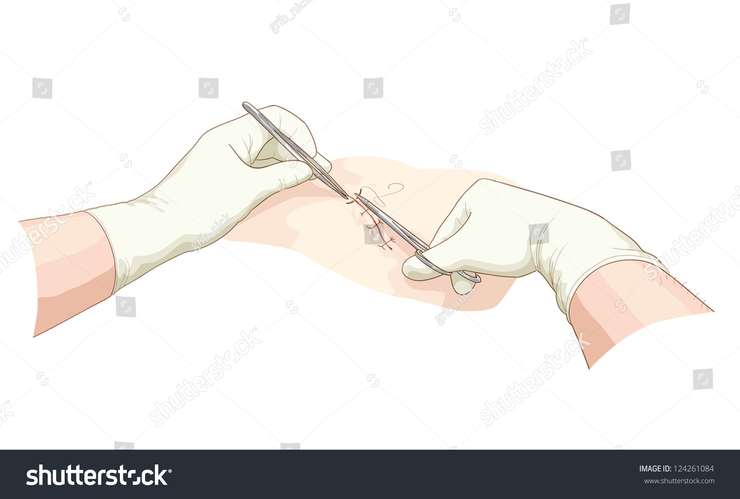 The Surgeon Takes In A Wound. Vector Illustration. - 124261084