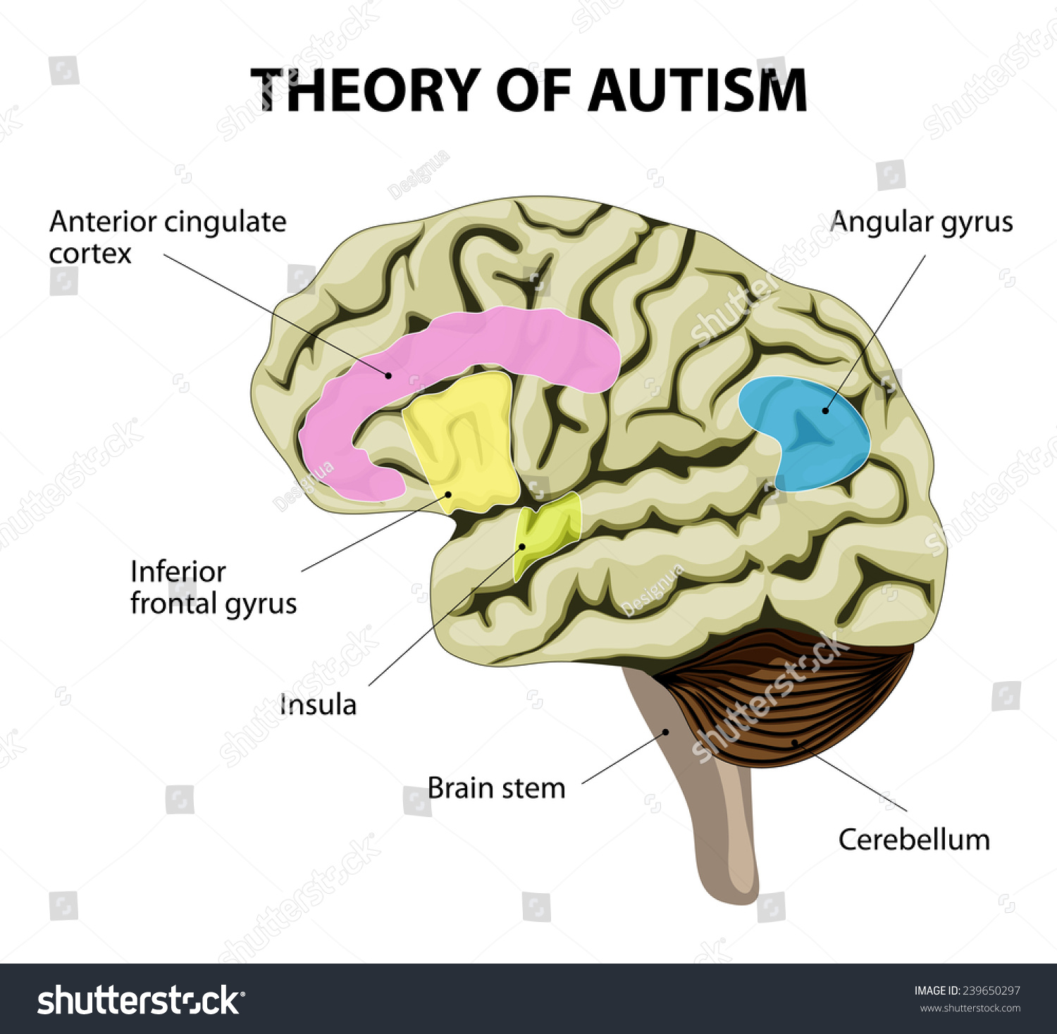 Theory Of Autism. Human Brain. Illustration Show Specific Abnormalities ...