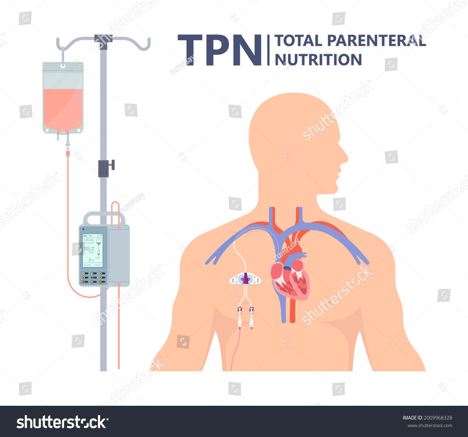 1 568 Tpn Images Stock Photos Vectors Shutterstock