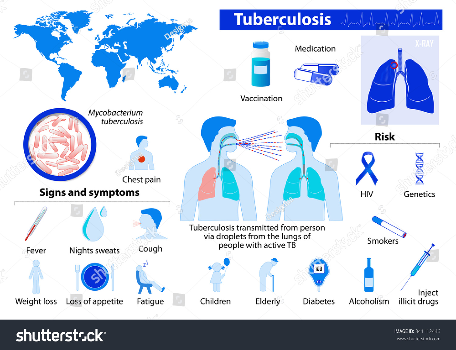 Tuberculosis. Medical Infographic Set Elements And Symbols For Design ...