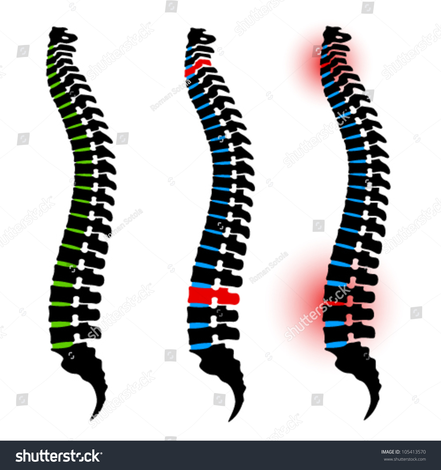free clip art human spine - photo #22