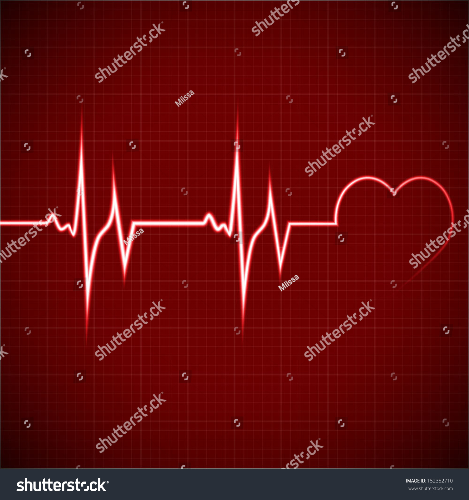 Vector Illustration Heart Rhythm Ekg - 152352710 : Shutterstock