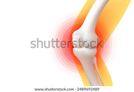 knee pain, X-ray of the leg, 3D visualization. Vector illustration