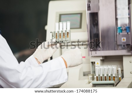 Urine samples ready to be processed in machine