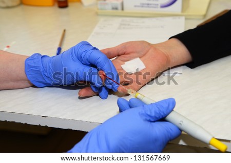 ROSTOV-ON-DON, RUSSIA - March 2:  An unknown donor\'s blood is tested before donation. The City Blood Service makes a promo action for donorship popularization, March 2, 2013 in Rostov-on-Don, Russia.