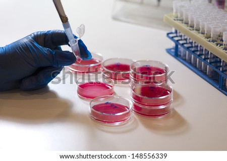 There are some Petri dishes with culture medium and cells inside. A person with a blue glove is pipetting the cells from a dish to a Eppendorf tube with a pipette made of transparent plastic