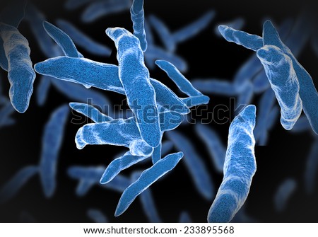 Bacterial infection tuberculosis