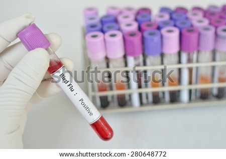 Blood sample with Bird Flu positive