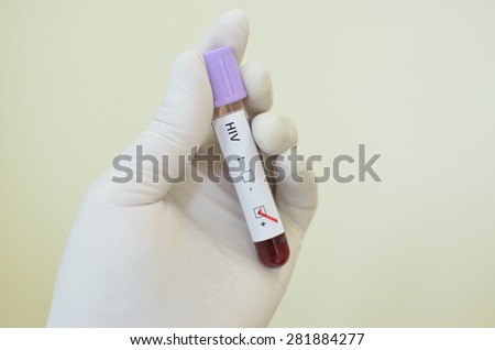 Blood sample with HIV positive