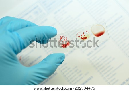 Blood  group testing by using slide method