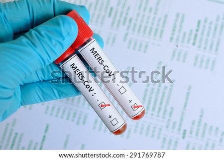 Blood sample with MERS-CoV (Middle East respiratory syndrome coronavirus) positive and negative